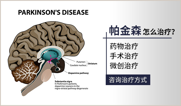 帕金森最新治疗方法研究与应用进展